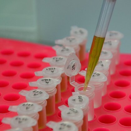 Arbeiten im Labor: Eppendorf Tubes werden mit einer Pipette befüllt
